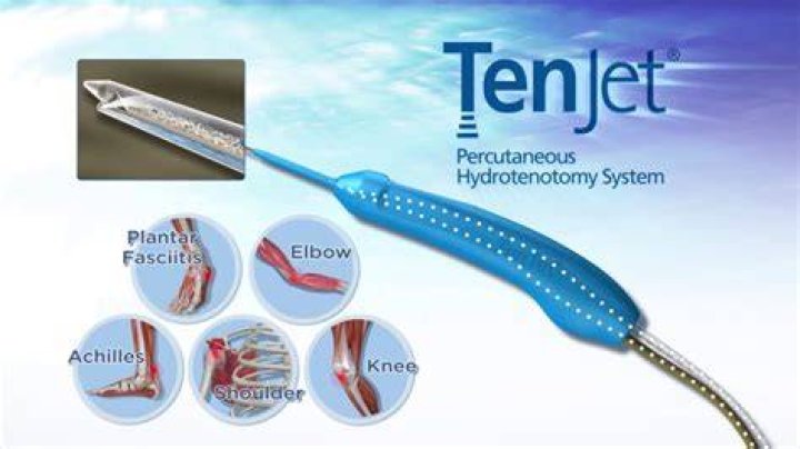 TenJet device